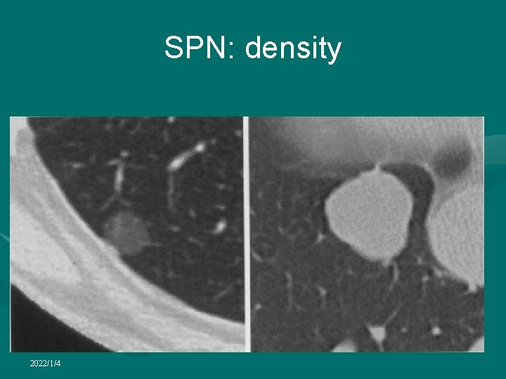 SPN: density 2022/1/4 