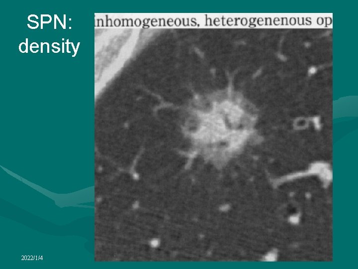 SPN: density 2022/1/4 
