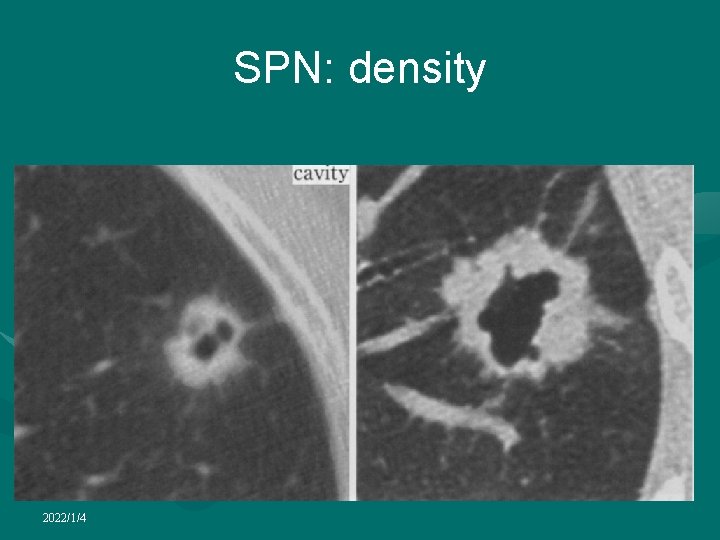 SPN: density 2022/1/4 