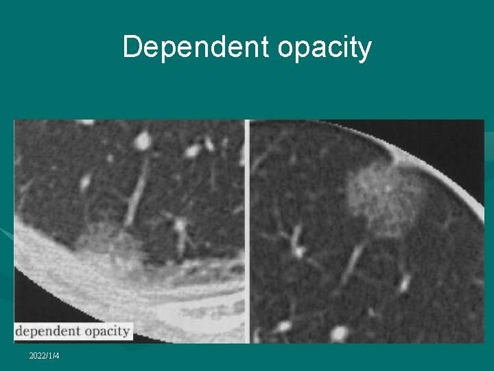 Dependent opacity 2022/1/4 