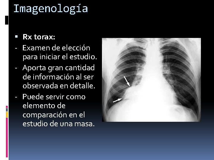 Imagenología Rx torax: - Examen de elección para iniciar el estudio. - Aporta gran