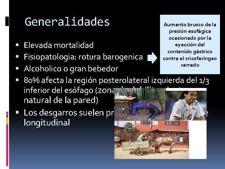 Generalidades Aumento brusco de la presión esofágica ocasionado por la eyección del contenido gástrico