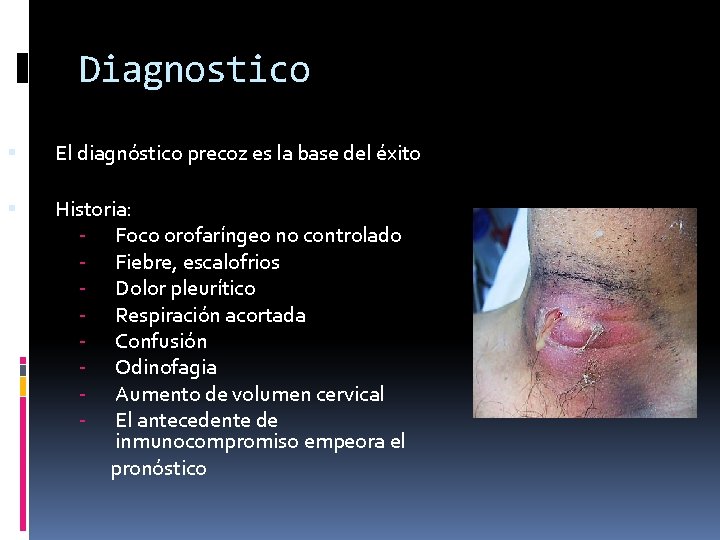 Diagnostico El diagnóstico precoz es la base del éxito Historia: - Foco orofaríngeo no