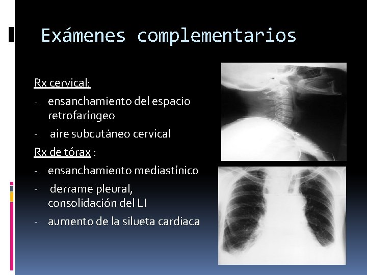 Exámenes complementarios Rx cervical: - ensanchamiento del espacio retrofaríngeo - aire subcutáneo cervical Rx