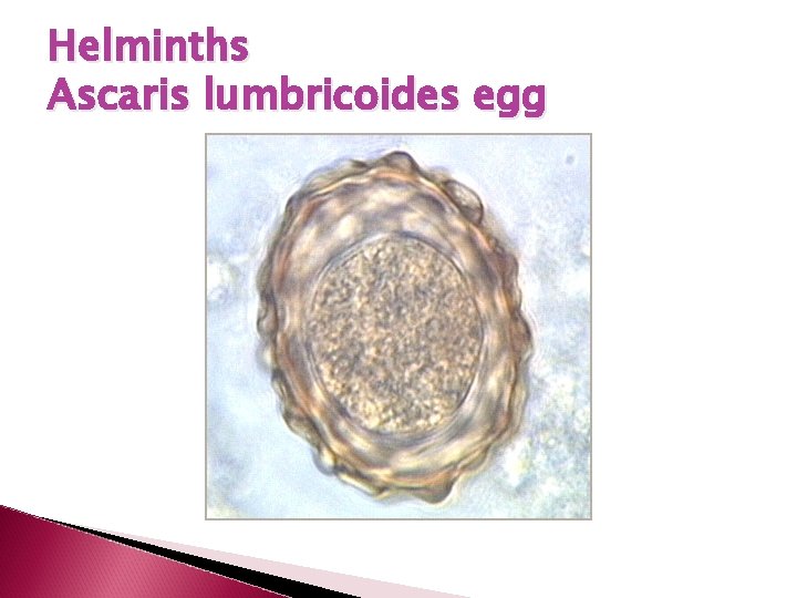Helminths Ascaris lumbricoides egg 