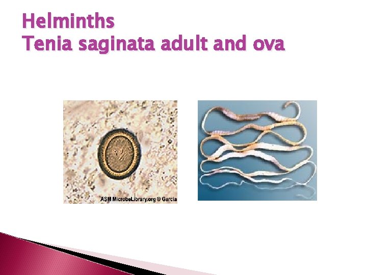 Helminths Tenia saginata adult and ova 