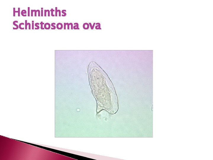 Helminths Schistosoma ova 