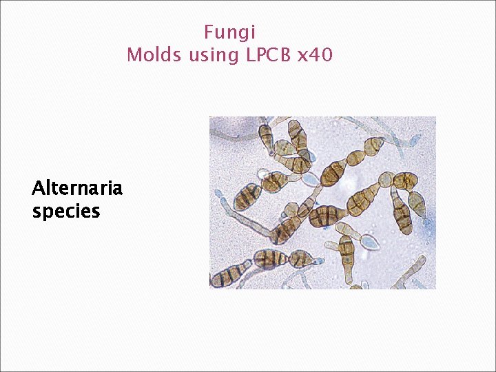 Fungi Molds using LPCB x 40 Alternaria species 