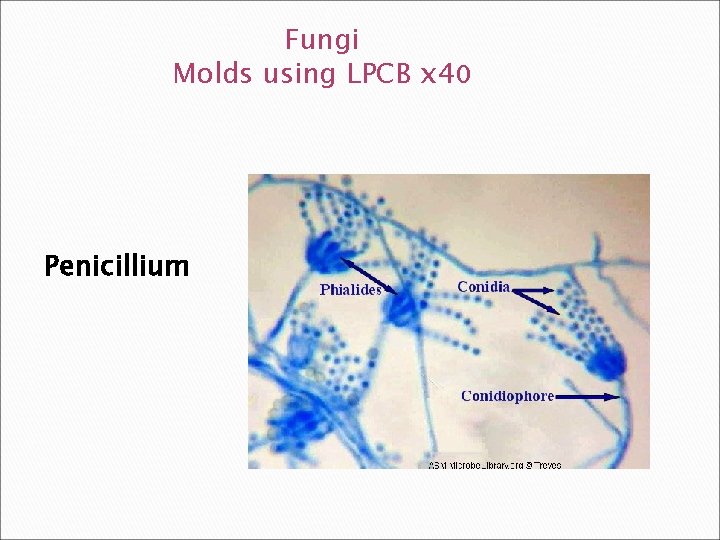 Fungi Molds using LPCB x 40 Penicillium 