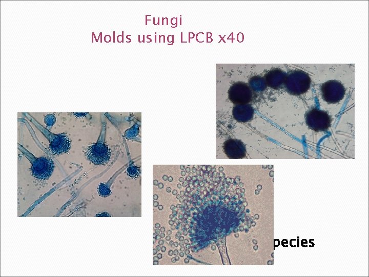 Fungi Molds using LPCB x 40 Aspergillus species 