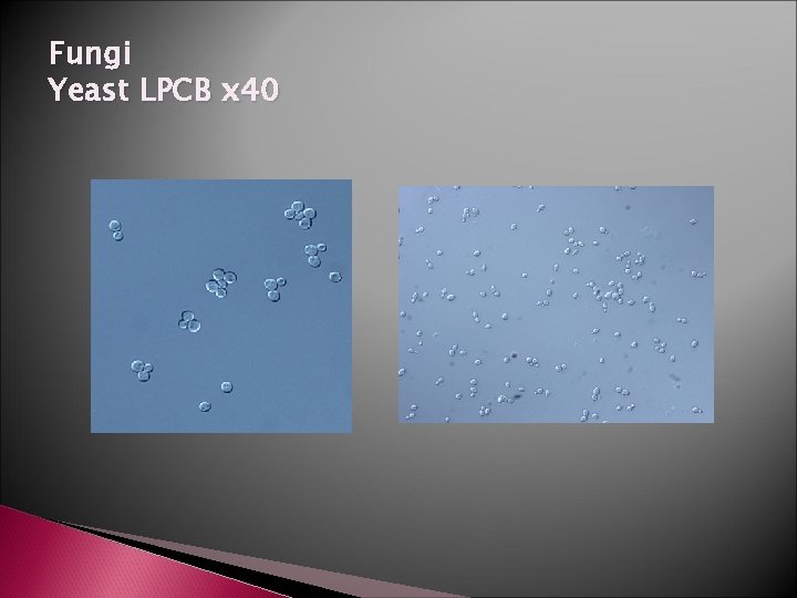 Fungi Yeast LPCB x 40 