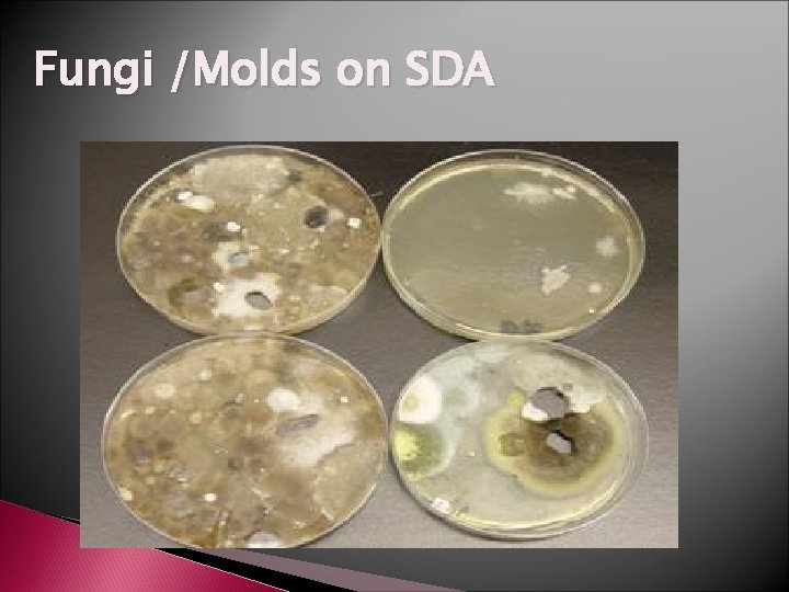 Fungi /Molds on SDA 