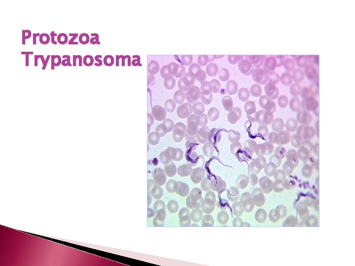 Protozoa Trypanosoma 