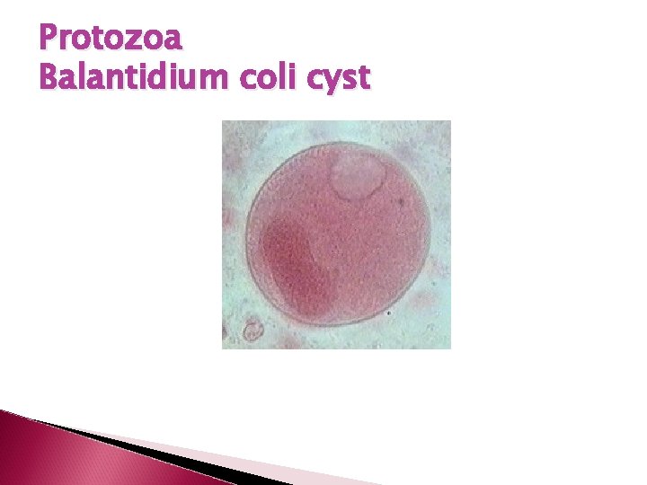 Protozoa Balantidium coli cyst 