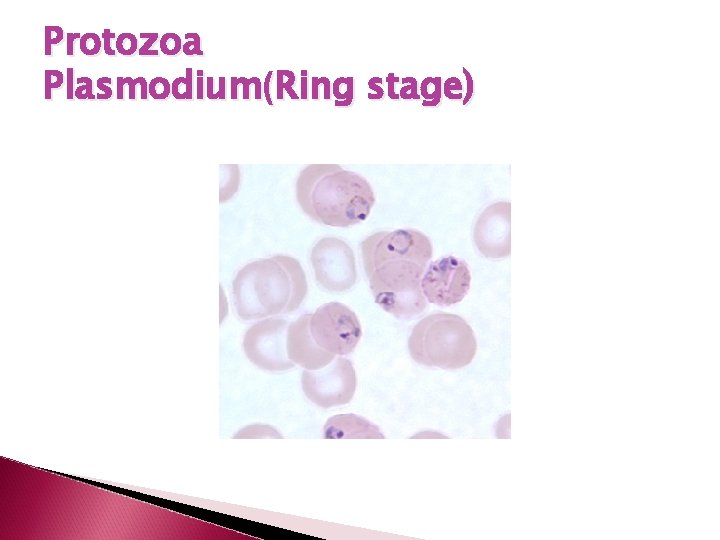 Protozoa Plasmodium(Ring stage) 