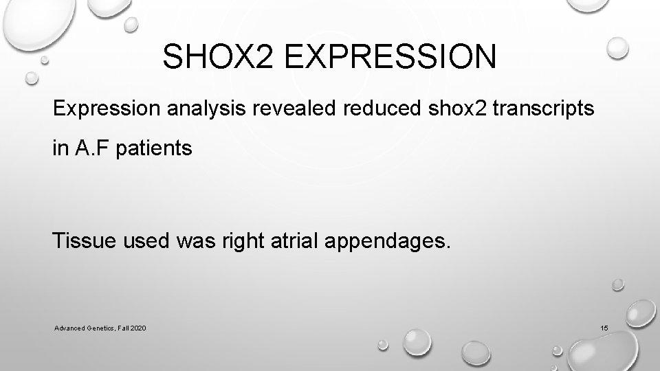SHOX 2 EXPRESSION Expression analysis revealed reduced shox 2 transcripts in A. F patients