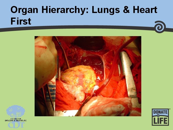 Organ Hierarchy: Lungs & Heart First 