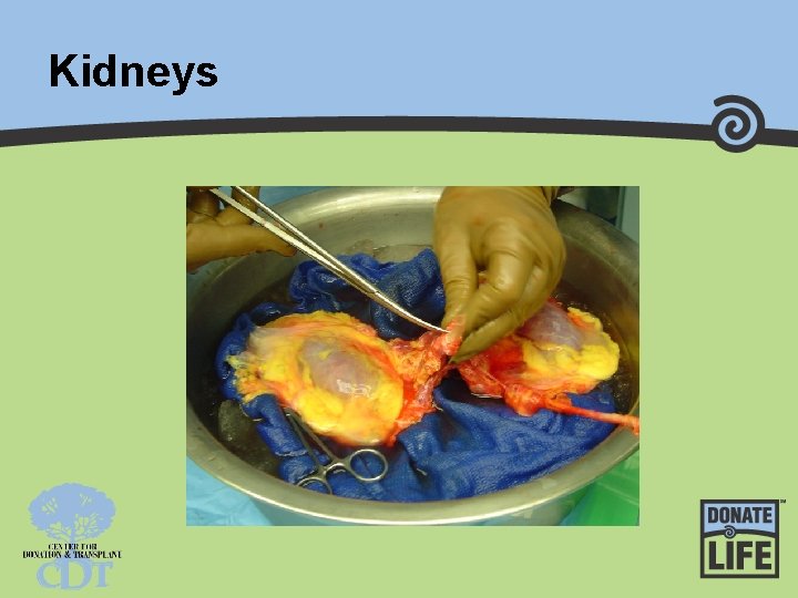 Kidneys 