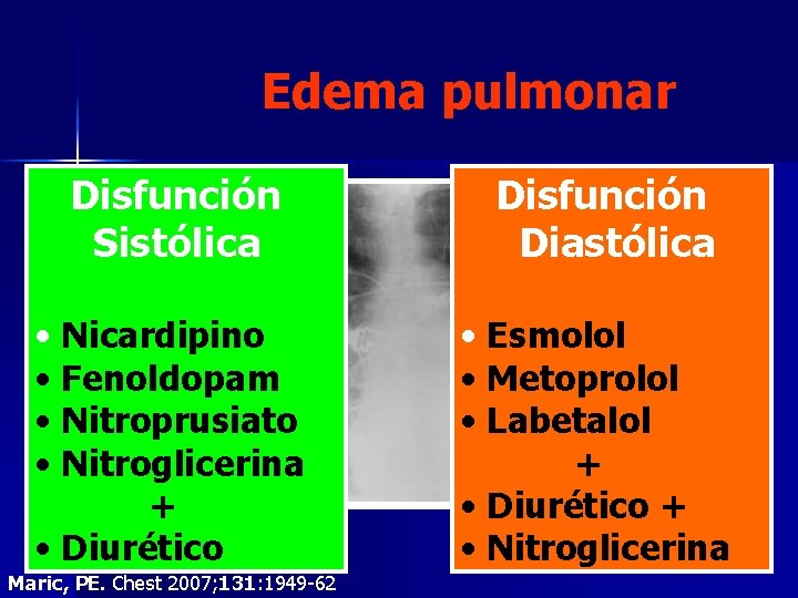 Edema pulmonar Disfunción Sistólica Disfunción Diastólica • Nicardipino • Fenoldopam • Nitroprusiato • Nitroglicerina Edema pulmonar Disfunción Sistólica Disfunción Diastólica • Nicardipino • Fenoldopam • Nitroprusiato • Nitroglicerina
