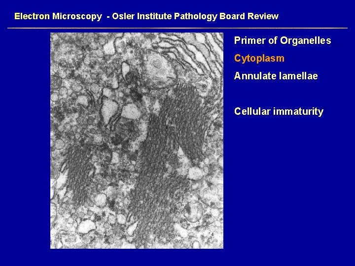 Electron Microscopy - Osler Institute Pathology Board Review Primer of Organelles Cytoplasm Annulate lamellae