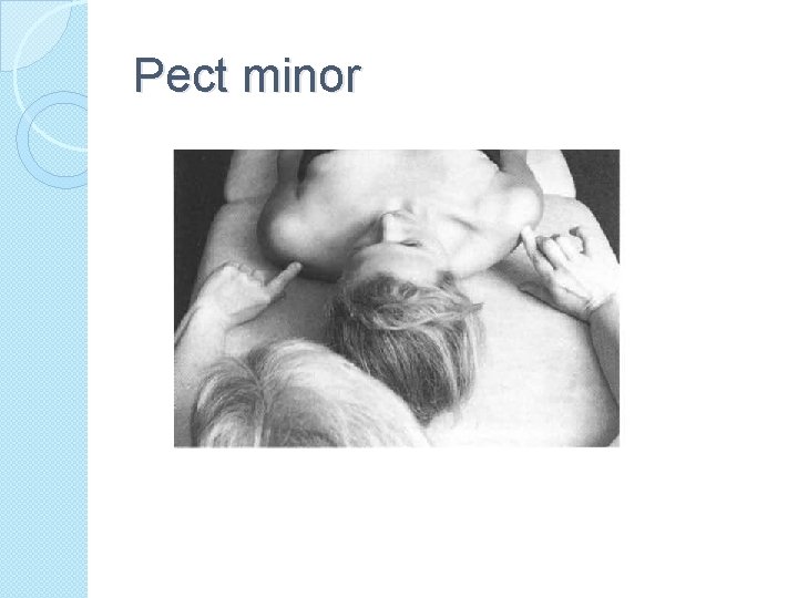 Pect minor 