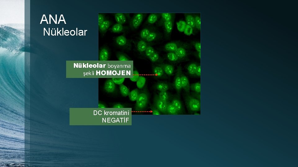 ANA Nükleolar boyanma şekli HOMOJEN DC kromatini NEGATİF 