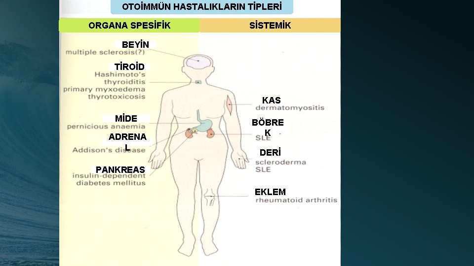 OTOİMMÜN HASTALIKLARIN TİPLERİ ORGANA SPESİFİK SİSTEMİK BEYİN TİROİD KAS MİDE ADRENA L BÖBRE K