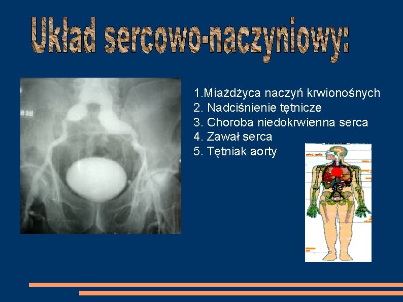 1. Miażdżyca naczyń krwionośnych 2. Nadciśnienie tętnicze 3. Choroba niedokrwienna serca 4. Zawał serca