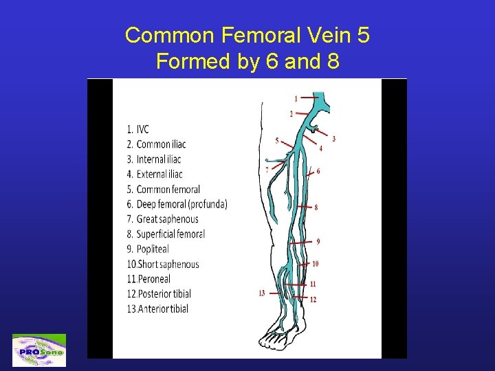 Common Femoral Vein 5 Formed by 6 and 8 