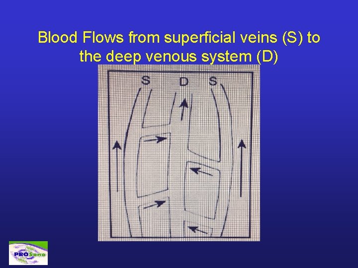 Blood Flows from superficial veins (S) to the deep venous system (D) 