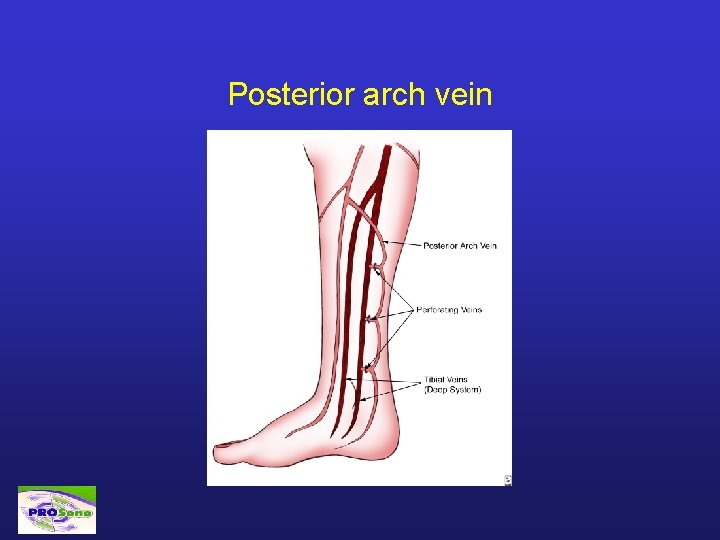 Posterior arch vein 