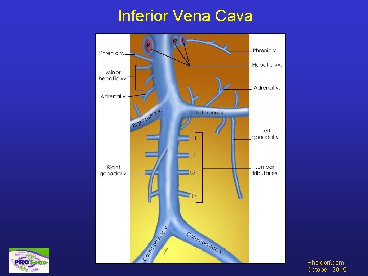 Inferior Vena Cava Hholdorf. com October, 2015 
