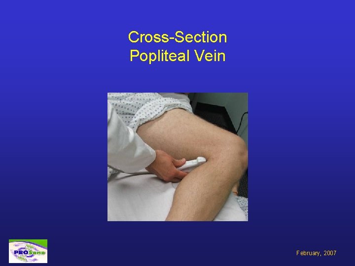 Cross-Section Popliteal Vein February, 2007 