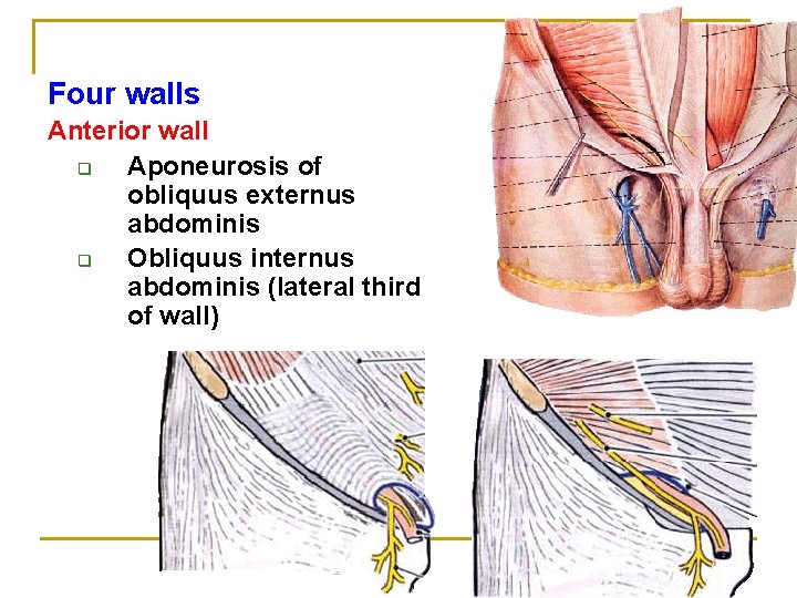 Four walls Anterior wall q Aponeurosis of obliquus externus abdominis q Obliquus internus abdominis