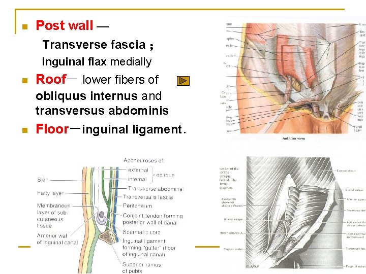 n Post wall — Transverse fascia ； Inguinal flax medially n Roof－ lower fibers