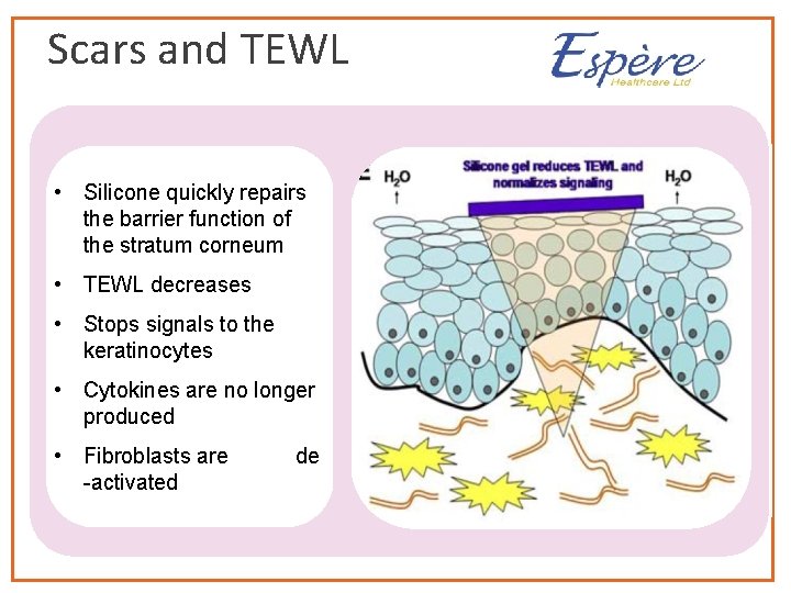 Scars and TEWL • Silicone quickly repairs the barrier function of the stratum corneum