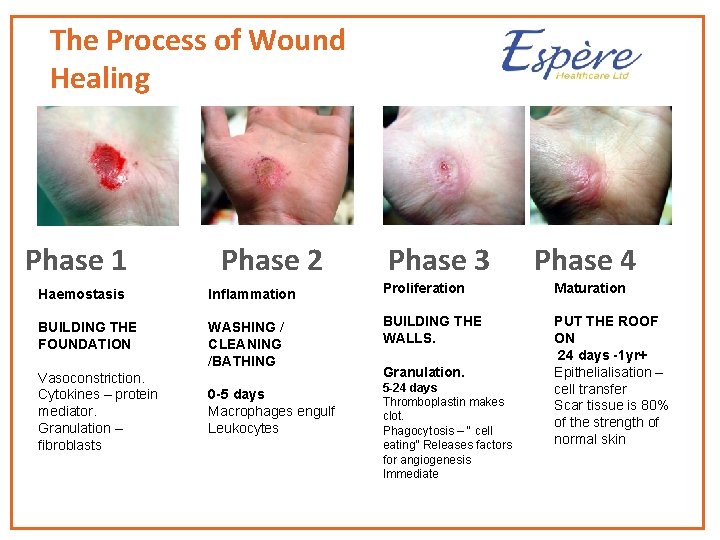 The Process of Wound Healing Phase 1 Phase 2 Phase 3 Phase 4 Haemostasis