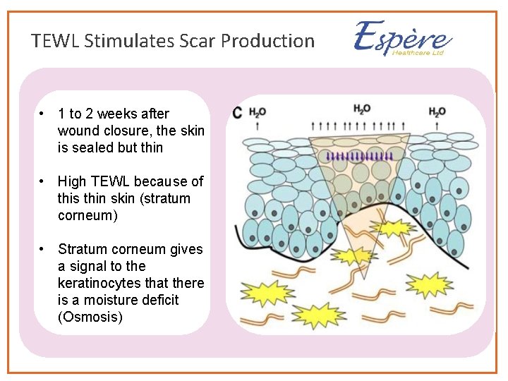 TEWL Stimulates Scar Production • 1 to 2 weeks after wound closure, the skin