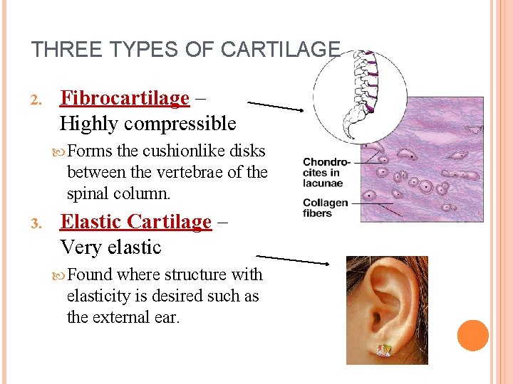 THREE TYPES OF CARTILAGE 2. Fibrocartilage – Highly compressible Forms the cushionlike disks between