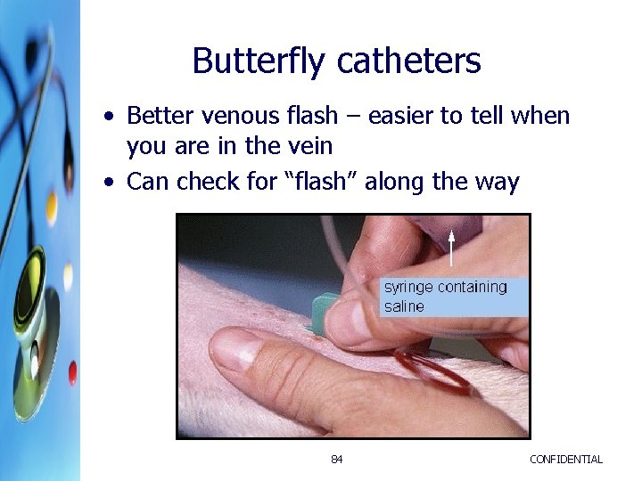 Butterfly catheters • Better venous flash – easier to tell when you are in Butterfly catheters • Better venous flash – easier to tell when you are in