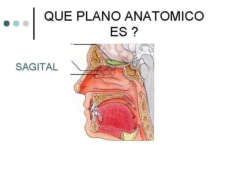 QUE PLANO ANATOMICO ES ? SAGITAL 