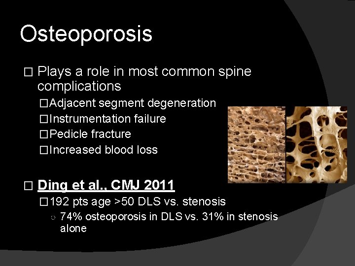 Osteoporosis � Plays a role in most common spine complications �Adjacent segment degeneration �Instrumentation