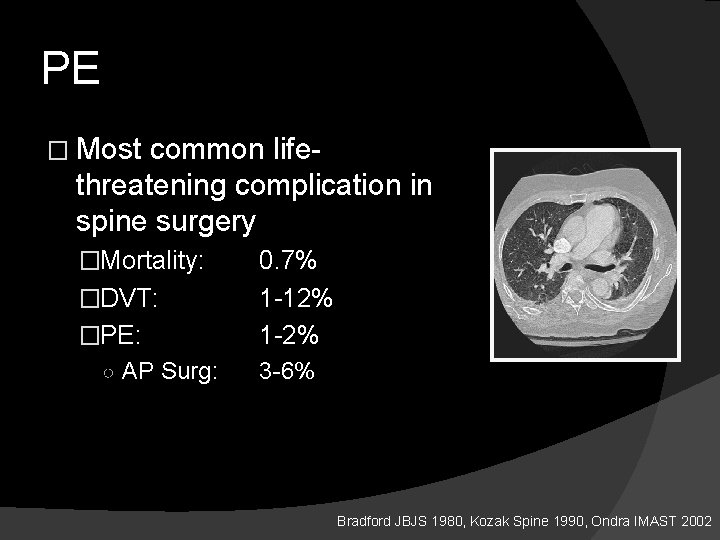 PE � Most common lifethreatening complication in spine surgery �Mortality: �DVT: �PE: ○ AP