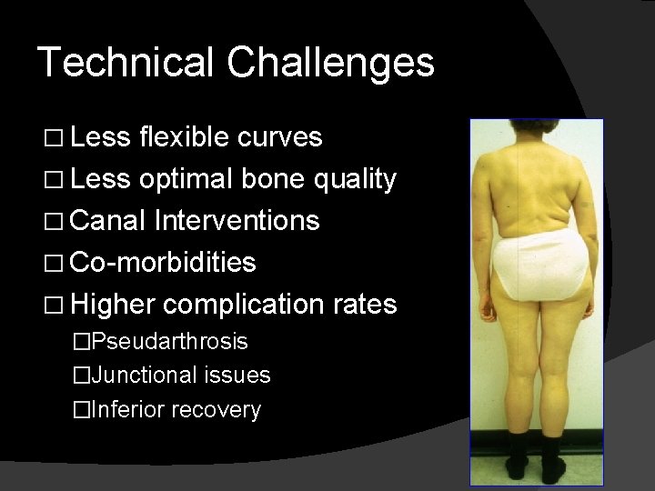 Technical Challenges � Less flexible curves � Less optimal bone quality � Canal Interventions