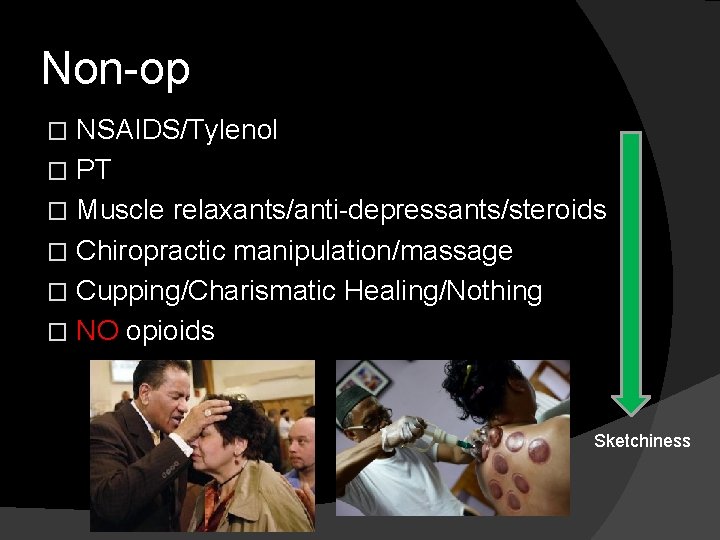 Non-op NSAIDS/Tylenol � PT � Muscle relaxants/anti-depressants/steroids � Chiropractic manipulation/massage � Cupping/Charismatic Healing/Nothing �