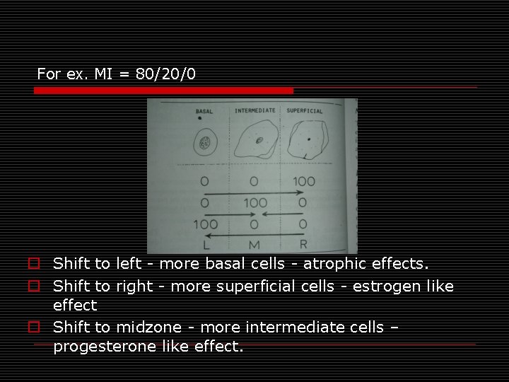 For ex. MI = 80/20/0 o Shift to left - more basal cells - For ex. MI = 80/20/0 o Shift to left - more basal cells -