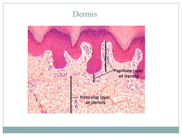 Dermis 