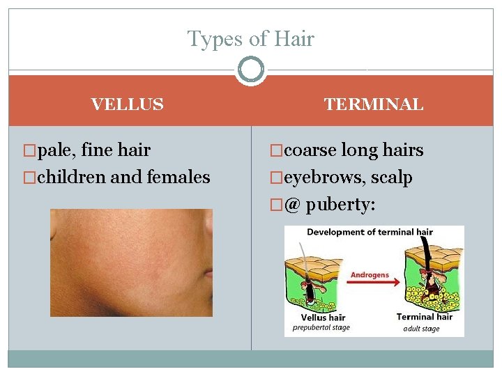 Types of Hair VELLUS TERMINAL �pale, fine hair �coarse long hairs �children and females