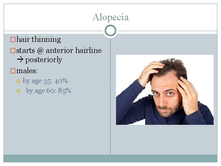 Alopecia �hair thinning �starts @ anterior hairline posteriorly �males: by age 35: 40% by