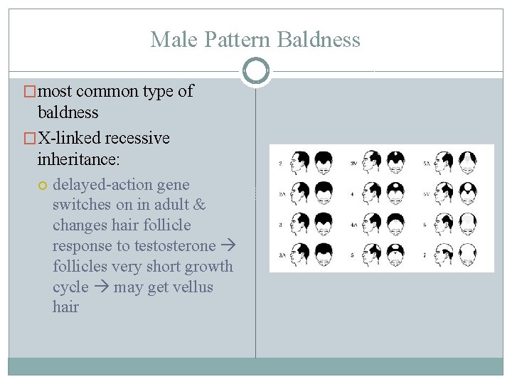 Male Pattern Baldness �most common type of baldness �X-linked recessive inheritance: delayed-action gene switches
